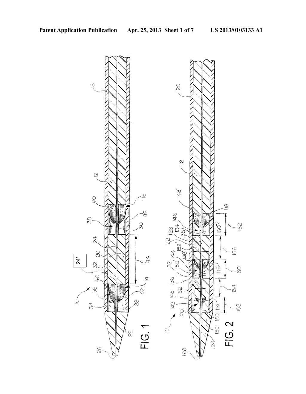 Placement of Multiple Intraluminal Medical Devices within a Body Vessel - diagram, schematic, and image 02