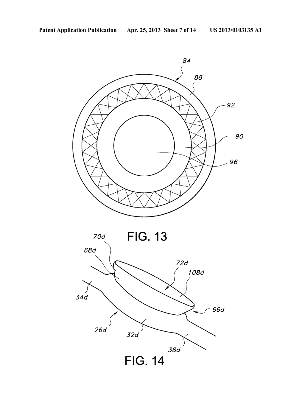 FENESTRATED INFLATABLE GRAFT - diagram, schematic, and image 08