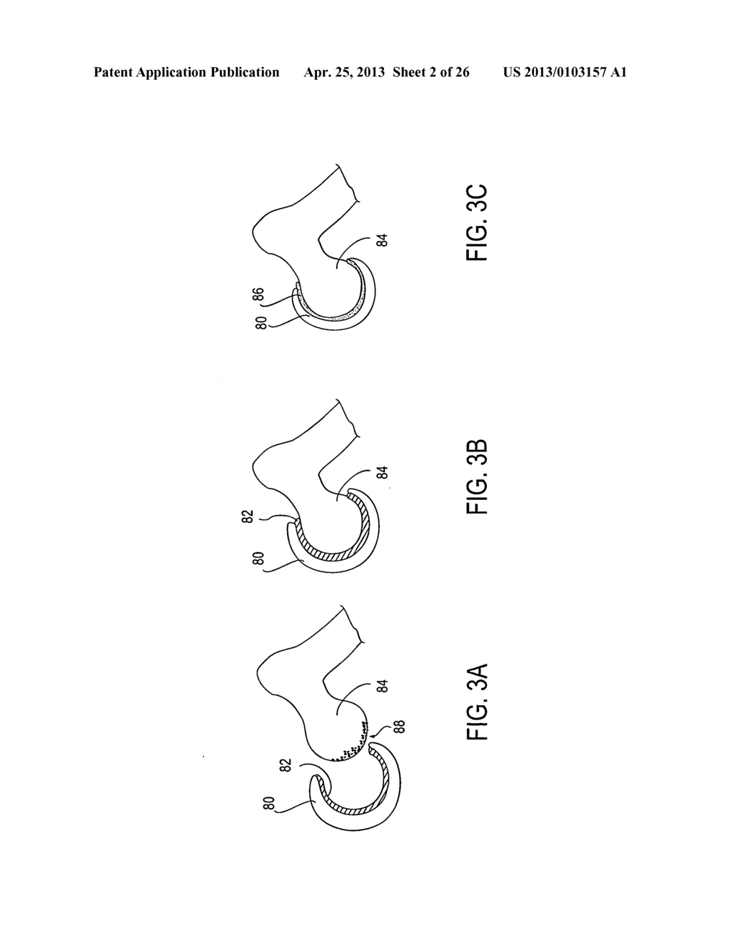 Polymeric adhesive for anchoring compliant materials to another surface - diagram, schematic, and image 03