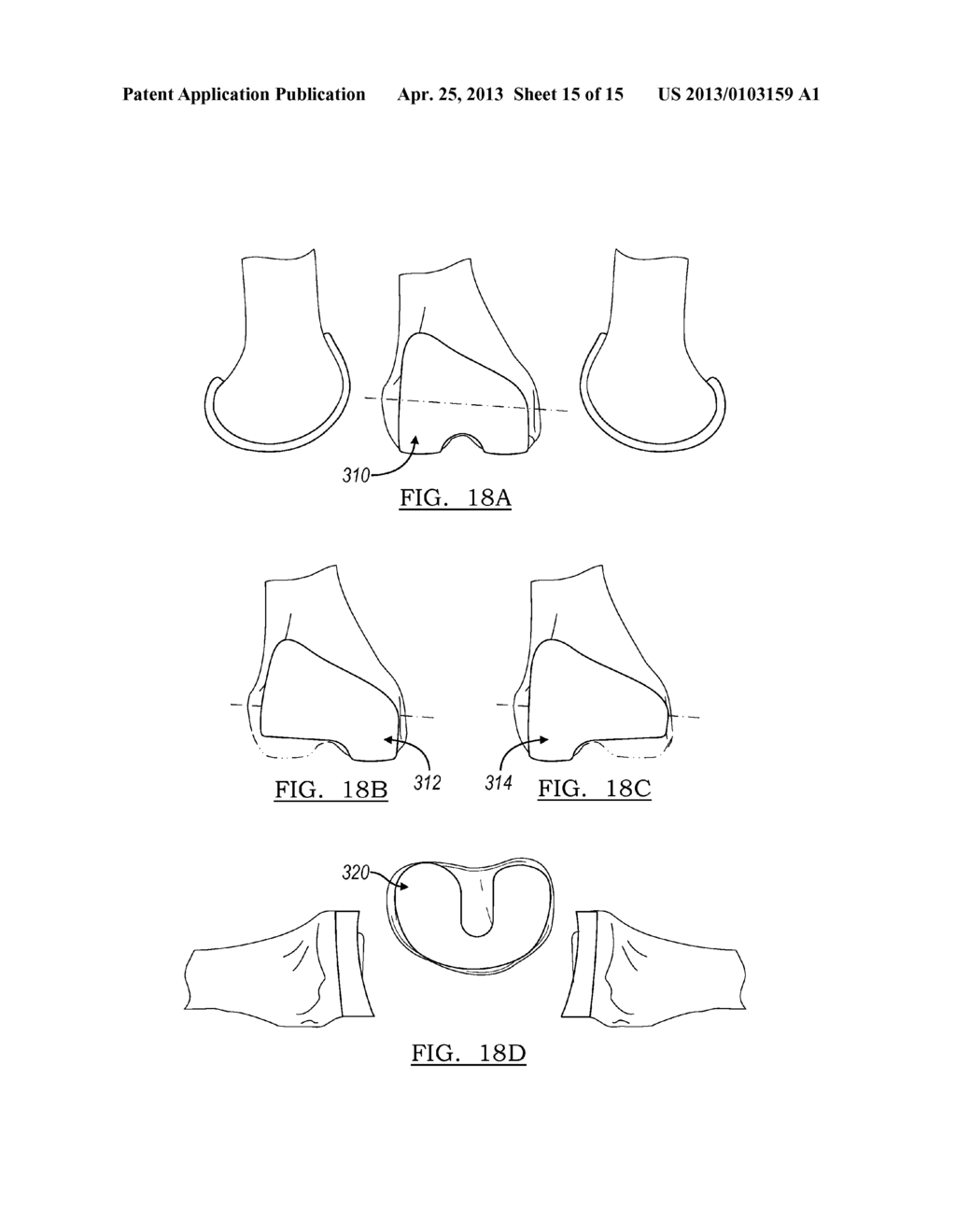 KNEE REPLACEMENT SYSTEM AND METHOD FOR ENABLING NATURAL KNEE MOVEMENT - diagram, schematic, and image 16