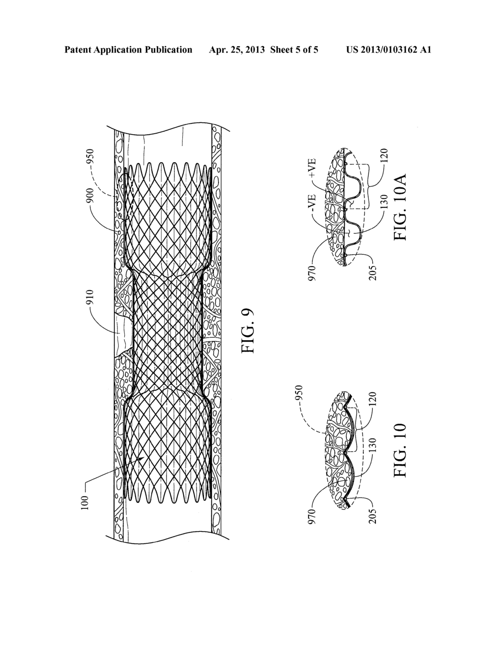 COATED STENT - diagram, schematic, and image 06