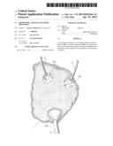 ORTHOTOPIC ARTIFICIAL BLADDER PROSTHESIS diagram and image