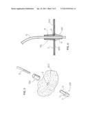 ORTHOTOPIC ARTIFICIAL BLADDER PROSTHESIS diagram and image