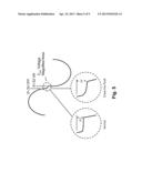 Safe Exposed Conductor Power Distribution System diagram and image