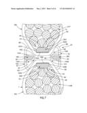 Bundle Spacing Device diagram and image