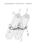 Bundle Spacing Device diagram and image