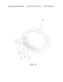 Clamping System Of Special Conductors For A Stator Or Rotor Bar Winding     For An Electric Machine diagram and image