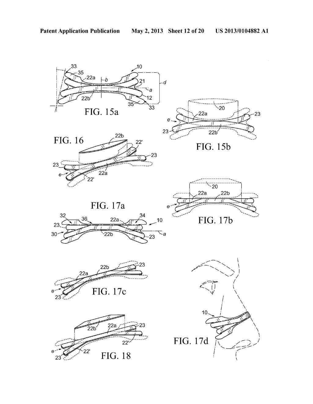 Overlapping Resilient Member Structures in Nasal Dilator Devices - diagram, schematic, and image 13