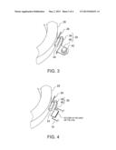 INSTRUMENT FOR ADJOINING TEMPERATURE DETECTING ELEMENT diagram and image