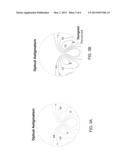 WAVEFRONT OPTIMIZED PROGRESSIVE LENS diagram and image