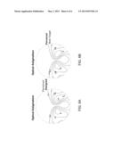 WAVEFRONT OPTIMIZED PROGRESSIVE LENS diagram and image