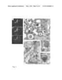 TRANSMEMBRANE PROSTATIC ACID PHOSPHATASE diagram and image