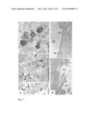 TRANSMEMBRANE PROSTATIC ACID PHOSPHATASE diagram and image