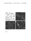 TRANSMEMBRANE PROSTATIC ACID PHOSPHATASE diagram and image