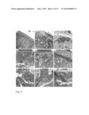 TRANSMEMBRANE PROSTATIC ACID PHOSPHATASE diagram and image