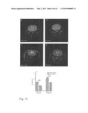 TRANSMEMBRANE PROSTATIC ACID PHOSPHATASE diagram and image