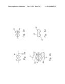 Reshapable Device for Fixation at a Dental Site diagram and image