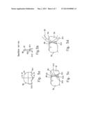 Reshapable Device for Fixation at a Dental Site diagram and image