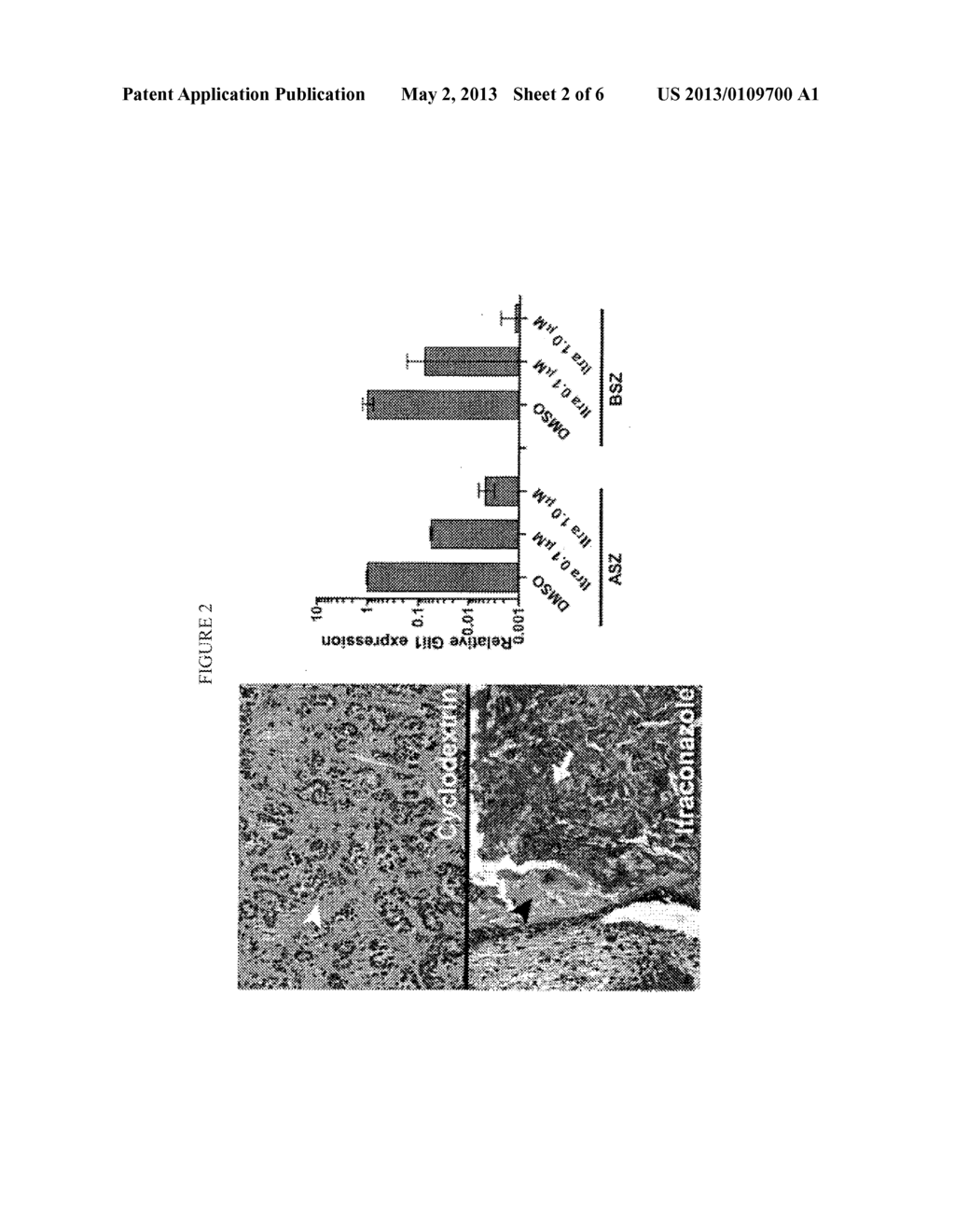 Topical Itraconazole Formulations and Uses Thereof - diagram, schematic, and image 03