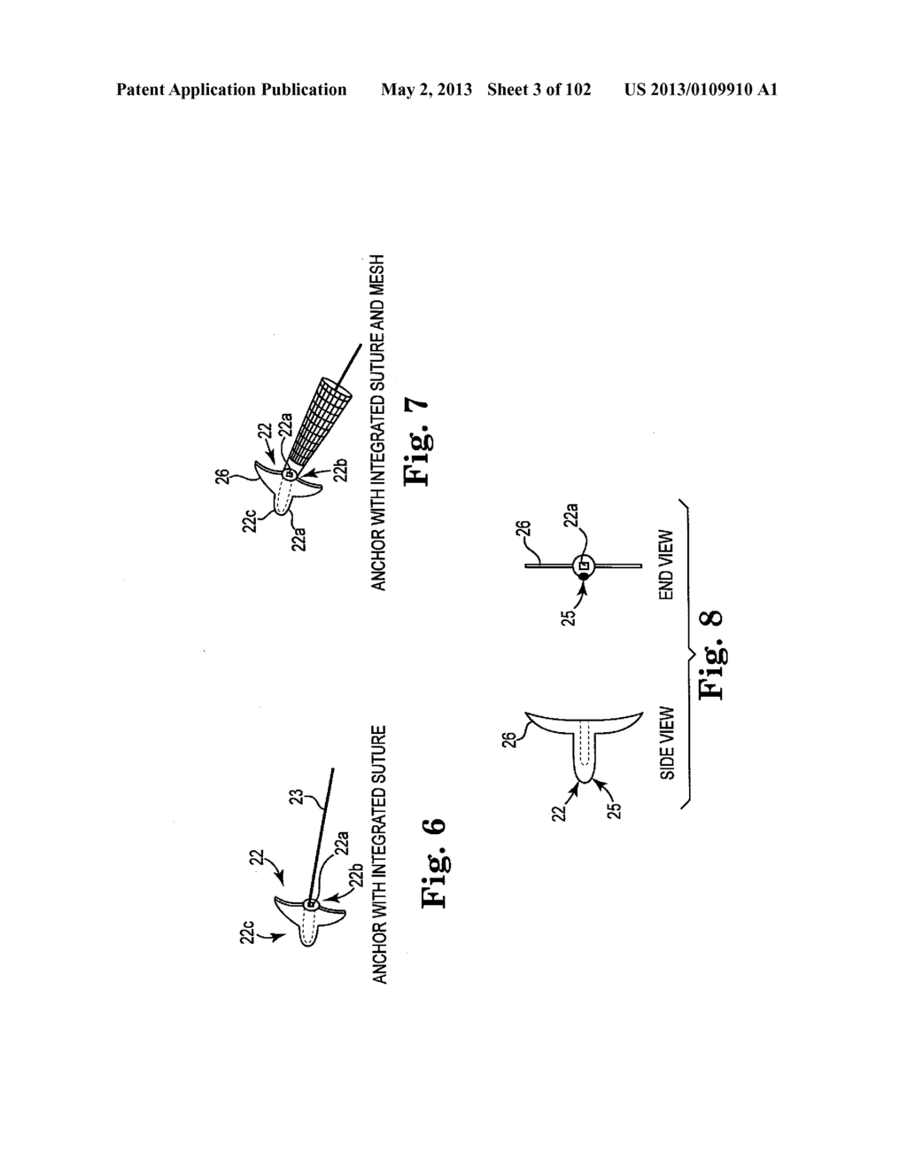 SYSTEMS, IMPLANTS, TOOLS, AND METHODS FOR TREATMENTS OF PELVIC CONDITIONS - diagram, schematic, and image 04