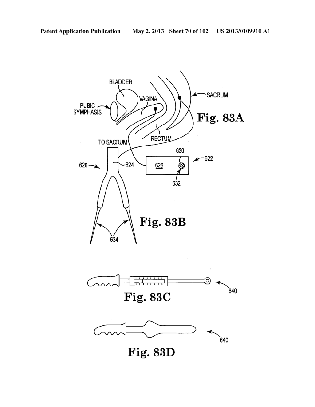 SYSTEMS, IMPLANTS, TOOLS, AND METHODS FOR TREATMENTS OF PELVIC CONDITIONS - diagram, schematic, and image 71