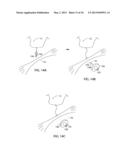 APPARATUS AND METHOD FOR INTRA-ABDOMINALLY MOVING A FIRST INTERNAL ORGAN     TO A POSITION AWAY FROM A SECOND INTERNAL ORGAN AND THEN HOLDING THE     FIRST INTERNAL ORGAN IN THE POSITION WITHOUT MANUAL INPUT diagram and image