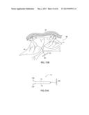 APPARATUS AND METHOD FOR INTRA-ABDOMINALLY MOVING A FIRST INTERNAL ORGAN     TO A POSITION AWAY FROM A SECOND INTERNAL ORGAN AND THEN HOLDING THE     FIRST INTERNAL ORGAN IN THE POSITION WITHOUT MANUAL INPUT diagram and image