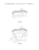APPARATUS AND METHOD FOR INTRA-ABDOMINALLY MOVING A FIRST INTERNAL ORGAN     TO A POSITION AWAY FROM A SECOND INTERNAL ORGAN AND THEN HOLDING THE     FIRST INTERNAL ORGAN IN THE POSITION WITHOUT MANUAL INPUT diagram and image