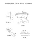 APPARATUS AND METHOD FOR INTRA-ABDOMINALLY MOVING A FIRST INTERNAL ORGAN     TO A POSITION AWAY FROM A SECOND INTERNAL ORGAN AND THEN HOLDING THE     FIRST INTERNAL ORGAN IN THE POSITION WITHOUT MANUAL INPUT diagram and image