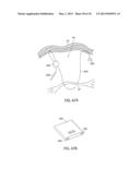 APPARATUS AND METHOD FOR INTRA-ABDOMINALLY MOVING A FIRST INTERNAL ORGAN     TO A POSITION AWAY FROM A SECOND INTERNAL ORGAN AND THEN HOLDING THE     FIRST INTERNAL ORGAN IN THE POSITION WITHOUT MANUAL INPUT diagram and image