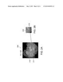 SYSTEM AND METHOD FOR DISPLAYING PORTIONS OF IN-VIVO IMAGES diagram and image