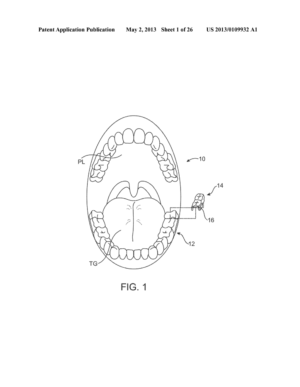 SYSTEMS AND METHODS FOR PULMONARY MONITORING AND TREATMENT - diagram, schematic, and image 02