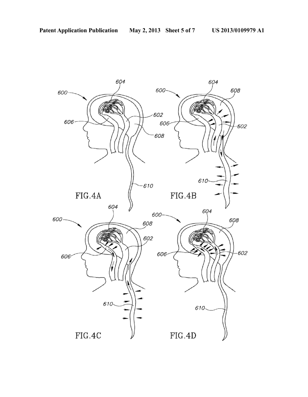 NON-INVASIVE INTRACRANIAL MONITOR - diagram, schematic, and image 06