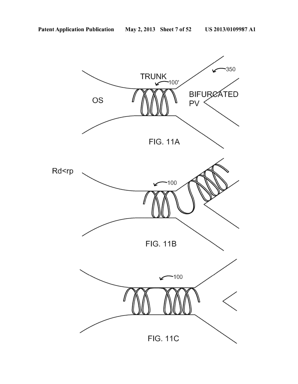 METHOD AND DEVICE FOR TREATMENT OF ARRHYTHMIAS AND OTHER MALADIES - diagram, schematic, and image 08