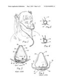 NASAL MASK diagram and image