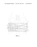 DEVICE AND METHOD FOR CONTROL OF HEMORRHAGE diagram and image