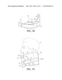 DEVICE AND METHOD FOR CONTROL OF HEMORRHAGE diagram and image