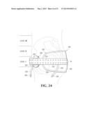 DEVICE AND METHOD FOR CONTROL OF HEMORRHAGE diagram and image