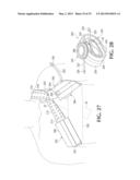 DEVICE AND METHOD FOR CONTROL OF HEMORRHAGE diagram and image