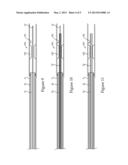 CLOT REMOVAL SYSTEM AND METHOD diagram and image