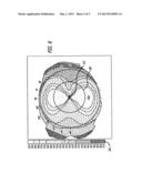 Method of correcting vision problems using only a photodisruption laser diagram and image