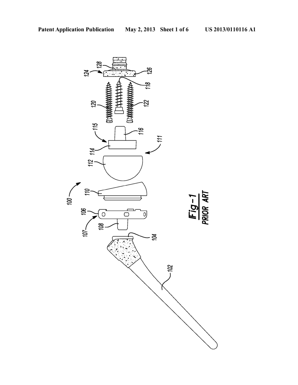 PATIENT-SPECIFIC GLENOID GUIDES - diagram, schematic, and image 02