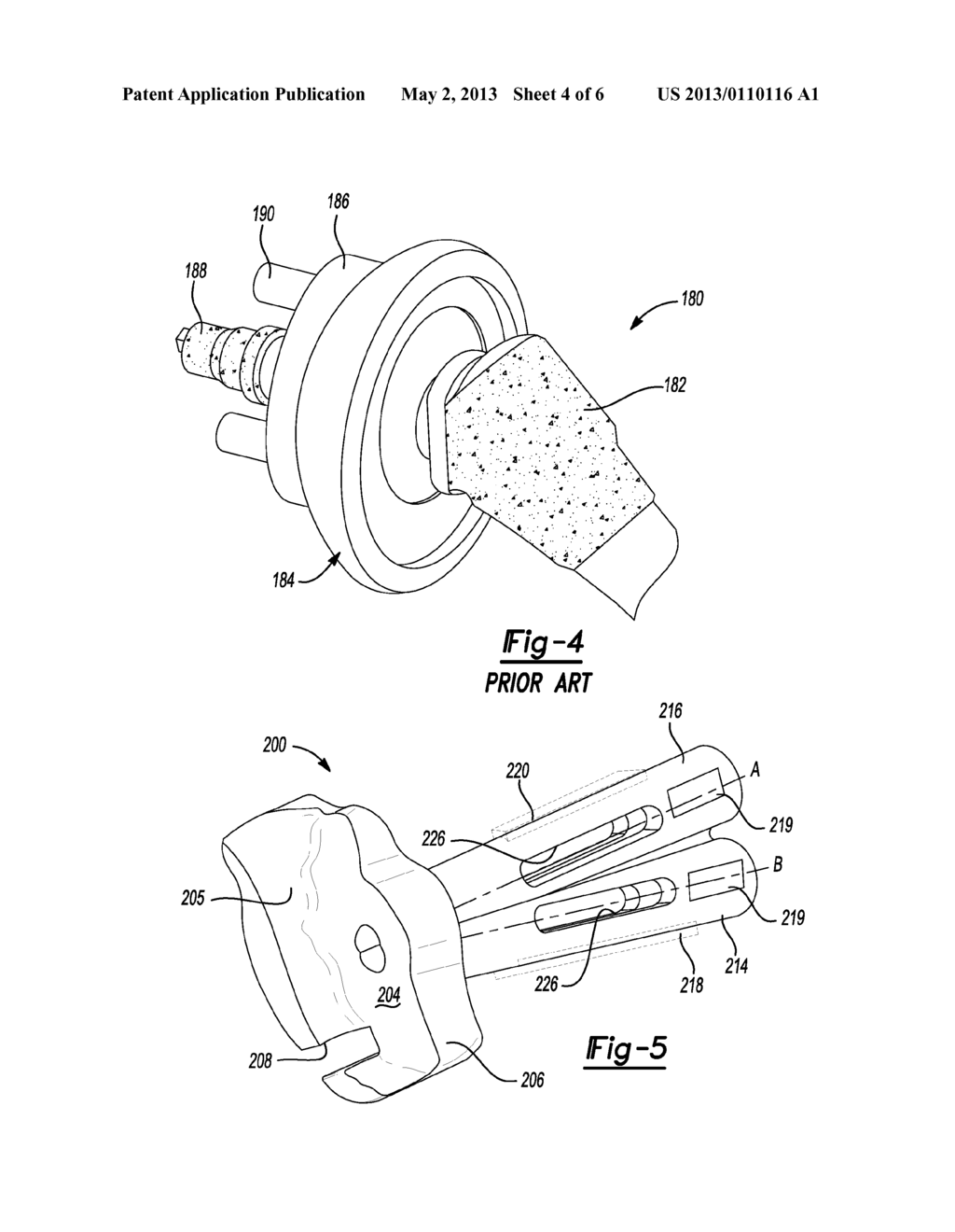 PATIENT-SPECIFIC GLENOID GUIDES - diagram, schematic, and image 05