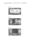 THREE-DIMENSIONAL SCAFFOLDS, METHODS FOR FABRICATING THE SAME, AND METHODS     OF TREATING A PERIPHERAL NERVE OR SPINAL CORD INJURY diagram and image