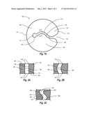 SUTURE CLIP diagram and image