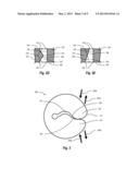 SUTURE CLIP diagram and image