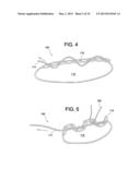 SOFT SUTURE-BASED ANCHORS diagram and image