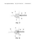 SOFT SUTURE-BASED ANCHORS diagram and image