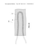 SOFT SUTURE-BASED ANCHORS diagram and image