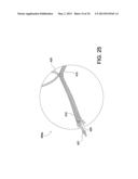 SOFT SUTURE-BASED ANCHORS diagram and image